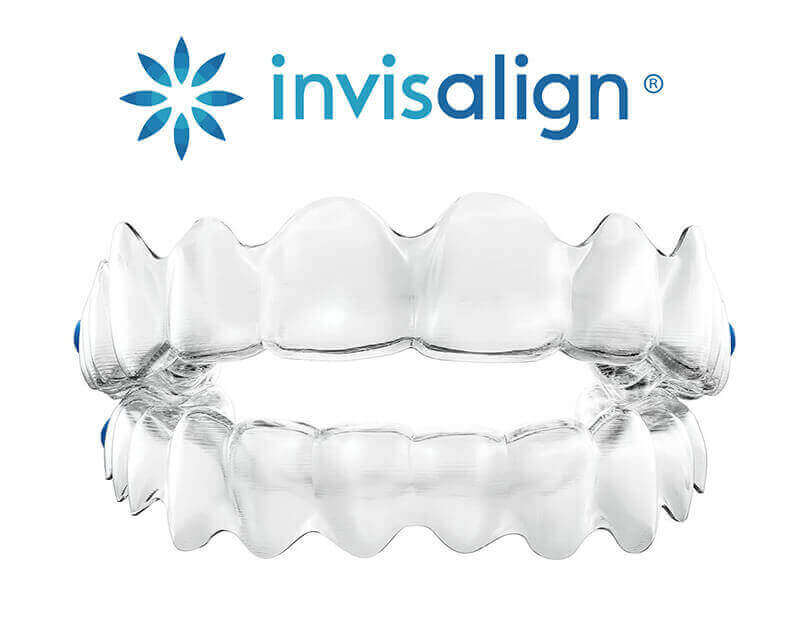 ds-invisalign-clear-aligners