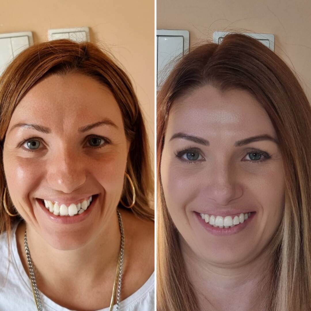 72ef9b36-8100-4936-bed0-9b83d0059e6d