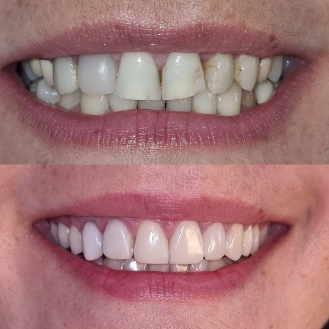 92c6e45b-d0b7-41d1-a90f-afda55fd7d12